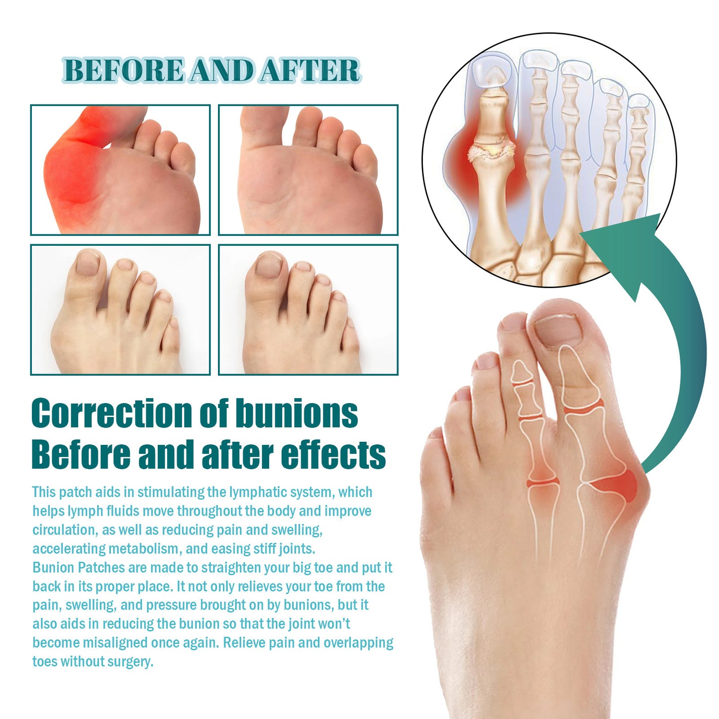 Bunion Patch Relieve Foot Toe Swelling Pain Patch