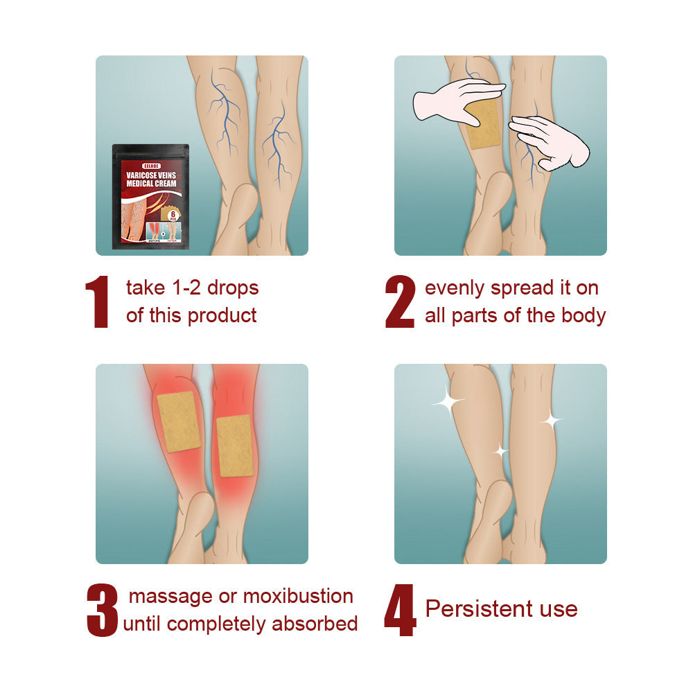 Leg Swelling, Earthworm Leg Vein Massage Pain Relief