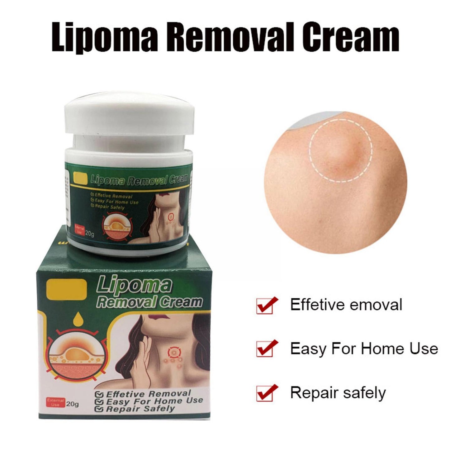 Chinese Medicine Multiple Anti-tumor Lipoma Pain Cream