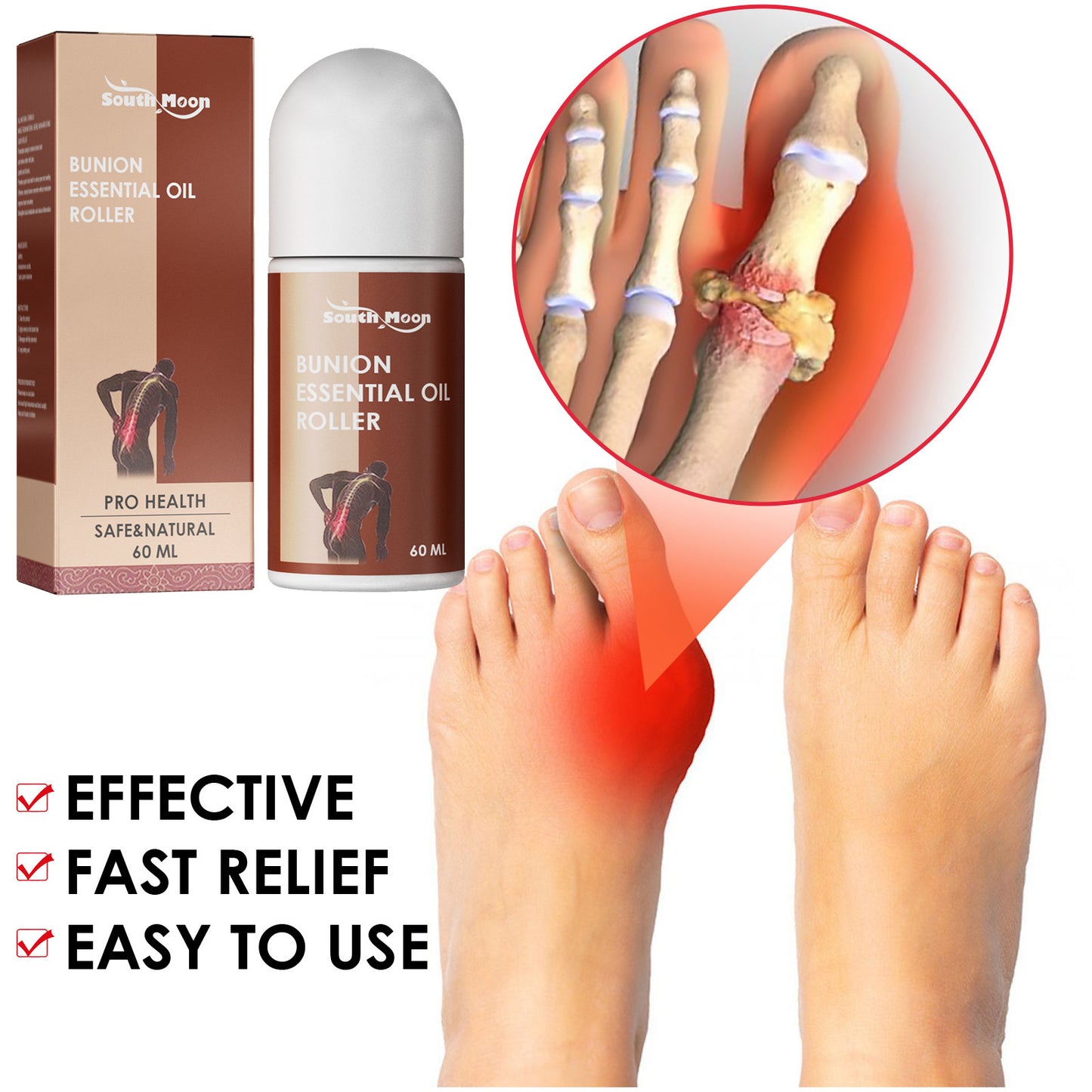 Correction Of Thumb Valgus With Thumb Bursitis Essential Oil Roller To Relieve Pain