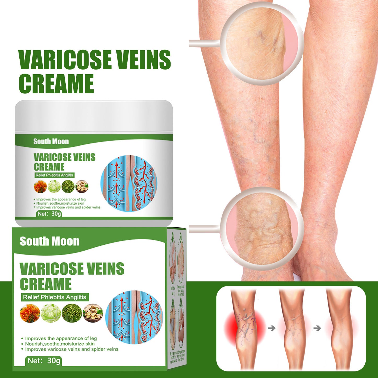 Blue Veins Bulging Pain Relief Leg Massage Cream