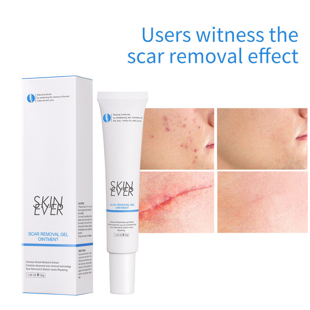 HERBAL SCAR REMOVAL GEL OINTME