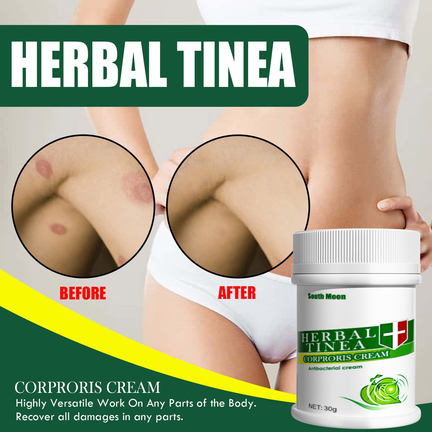 Herbal Skin Antibacterial Cream Efficacy On Skin Skin Care Moisturizing