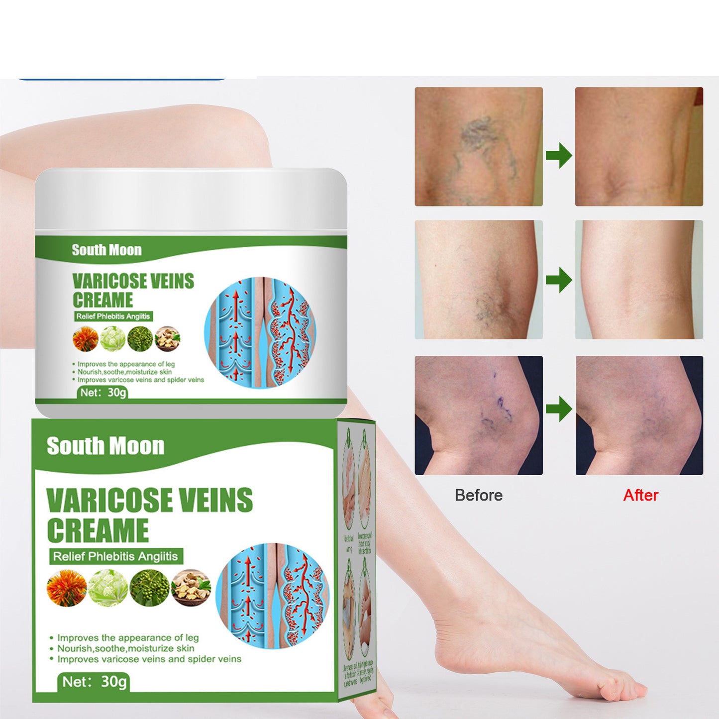 Blue Veins Bulging Pain Relief Leg Massage Cream