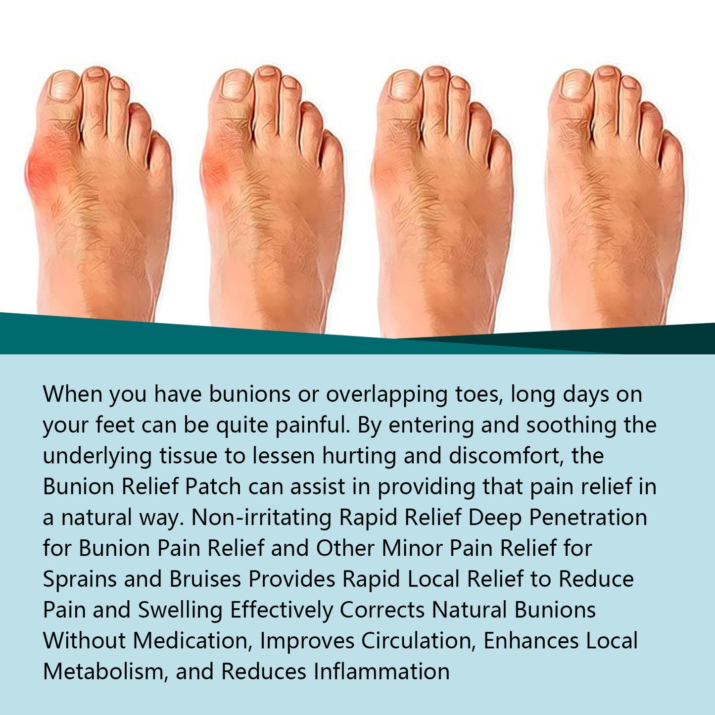 Bunion Patch Relieve Foot Toe Swelling Pain Patch